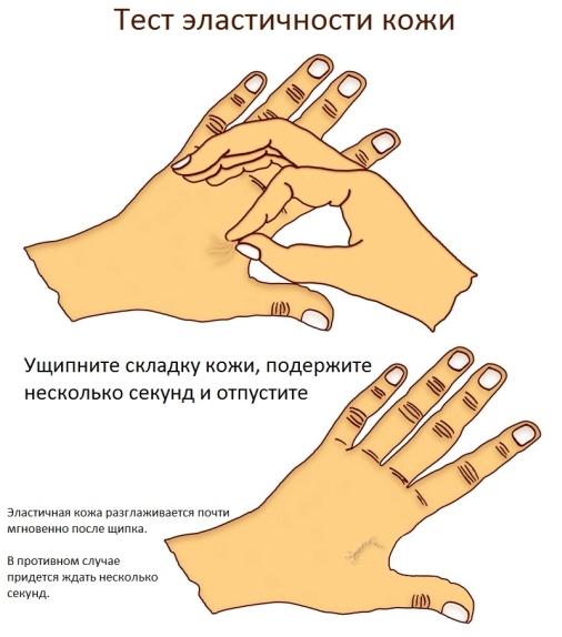 Эластичность кожи тест